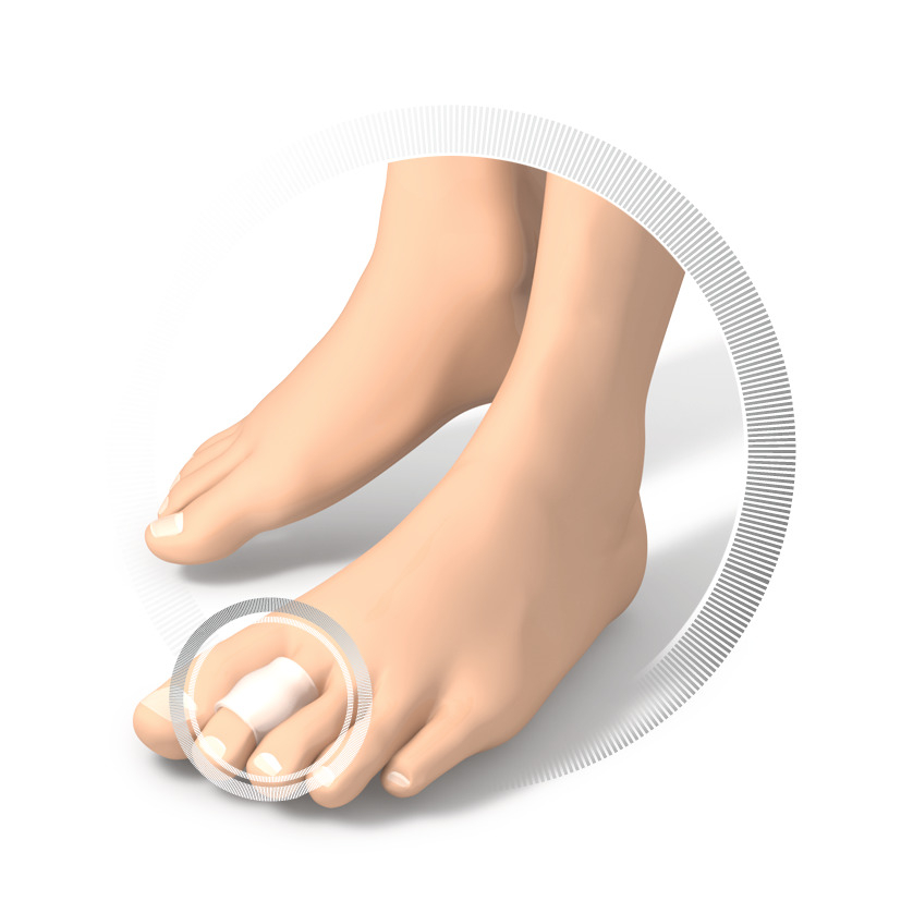 RUCK DRUCKSCHUTZ silicon Korrekturringe | Gr. 3 Ø 18 mm | 10 Stück RUCK DRUCKSCHUTZ silicon Korrekturringe | Gr. 3 Ø 18 mm | 10 Stück