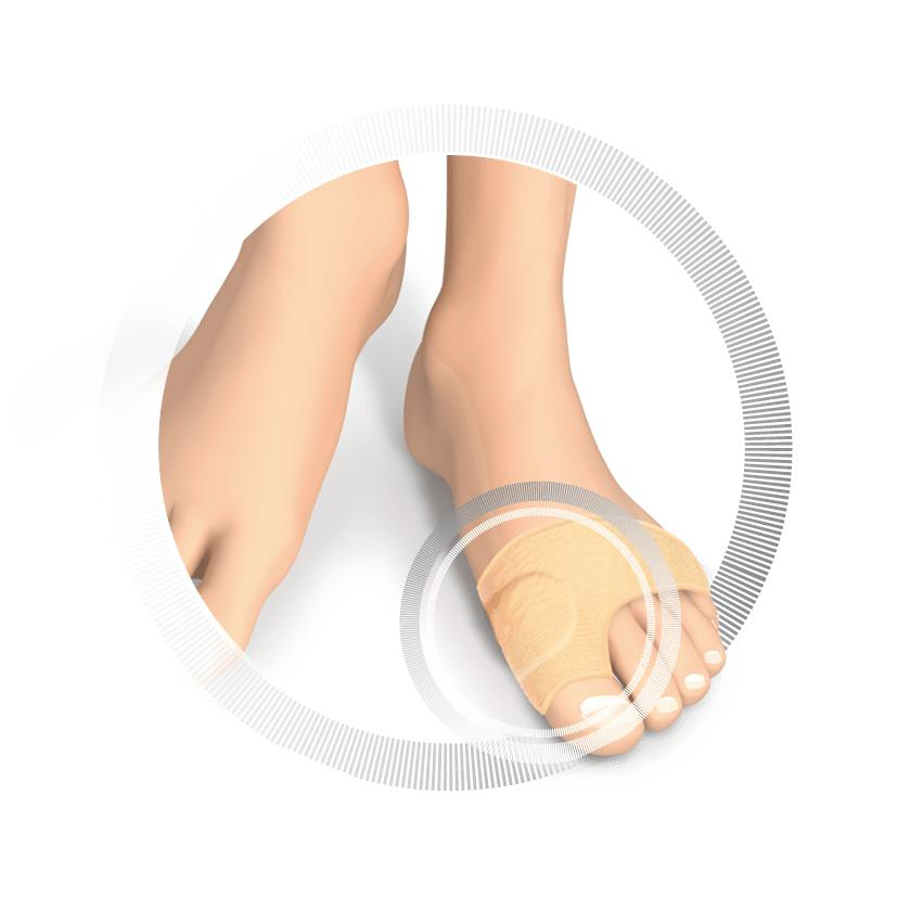 RUCK DRUCKSCHUTZ smartgel Ballenschutz 3mm 41-46 | Gelkissen unbedeckt