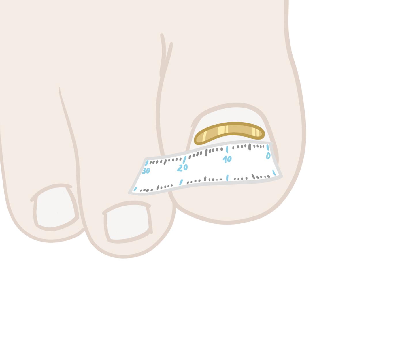 RUCK Nagelkorrektur Goldstadt professional Klebespange Gr. 23 Stärke 0,1 mm