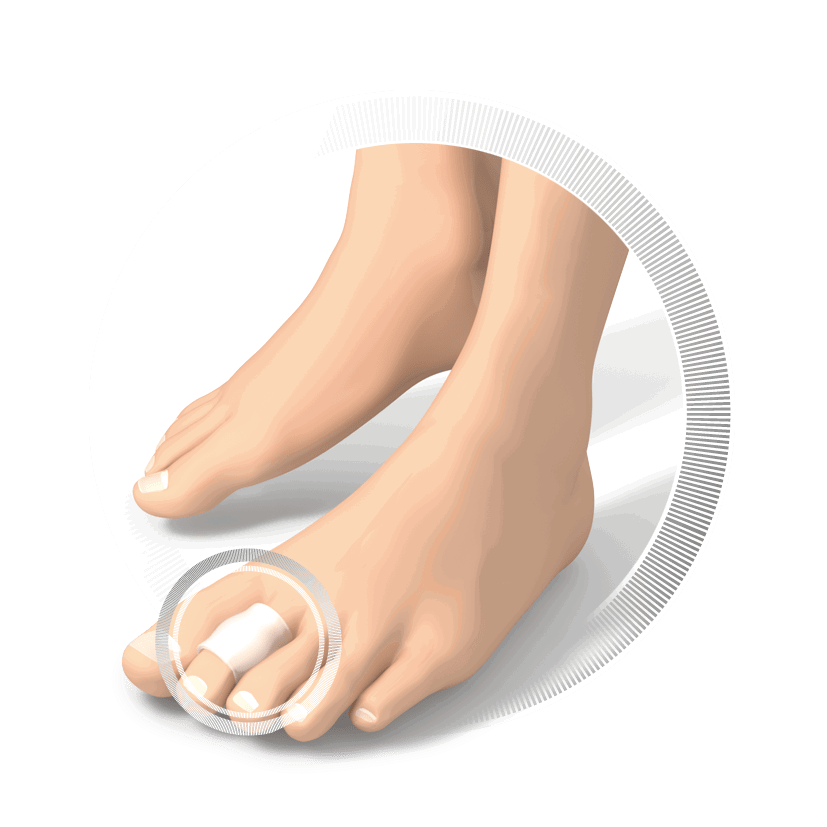 RUCK DRUCKSCHUTZ silicon Korrekturringe | Gr. 2 Ø 14 mm | 10 Stück RUCK DRUCKSCHUTZ silicon Korrekturringe | Gr. 2 Ø 14 mm | 10 Stück